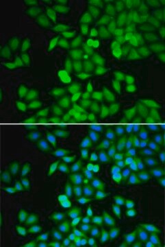 Anti- RhoGDI antibody produced in rabbit