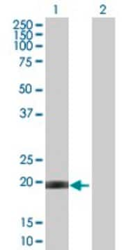 Anti-CETN1 antibody produced in mouse purified immunoglobulin, buffered aqueous solution