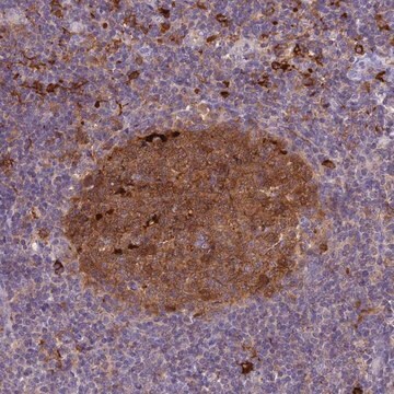 Anti-UBE2G1 antibody produced in rabbit Prestige Antibodies&#174; Powered by Atlas Antibodies, affinity isolated antibody, buffered aqueous glycerol solution