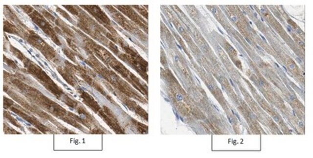 Anticuerpo anti-miostatina, cerca del CT from rabbit, purified by affinity chromatography