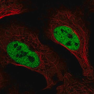 Anty-SLC4A3 Prestige Antibodies&#174; Powered by Atlas Antibodies, affinity isolated antibody