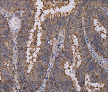 Anti-REG3G antibody produced in rabbit affinity isolated antibody