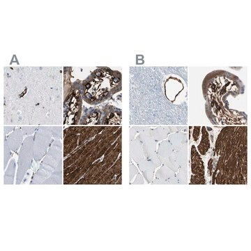 Anti-CALD1 antibody produced in rabbit Prestige Antibodies&#174; Powered by Atlas Antibodies, affinity isolated antibody, buffered aqueous glycerol solution