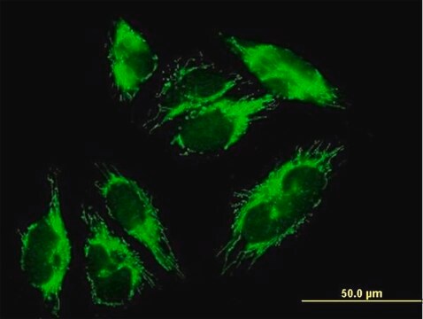 Anti-HIBADH antibody produced in mouse IgG fraction of antiserum, buffered aqueous solution