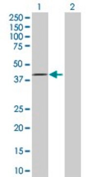 Anti-FBXO28 antibody produced in rabbit purified immunoglobulin, buffered aqueous solution