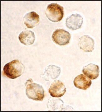 Anti-IKK beta antibody produced in rabbit affinity isolated antibody