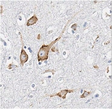 Anticorpo anti-subunità KCNQ5 del canale del potassio from rabbit, purified by affinity chromatography