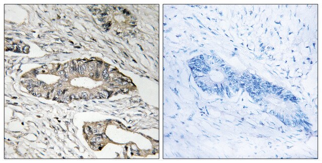 Anti-EPN3 antibody produced in rabbit affinity isolated antibody