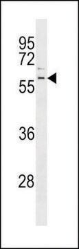 ANTI-PARKIN(C-TERMINAL) antibody produced in rabbit purified immunoglobulin, buffered aqueous solution