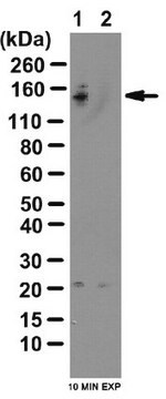 抗リン酸化TBC1D1抗体（Ser237） from rabbit, purified by affinity chromatography