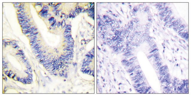 Anti-IRS-1 antibody produced in rabbit affinity isolated antibody