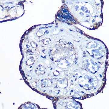 Anti-N-WASP/WASL antibody produced in rabbit