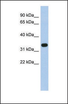 Anti-SULT1B1, (N-terminal) antibody produced in rabbit affinity isolated antibody