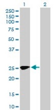 Anti-MMACHC antibody produced in mouse purified immunoglobulin, buffered aqueous solution