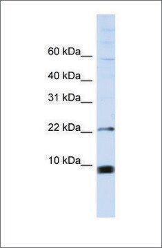 Anti-SNRPF antibody produced in rabbit affinity isolated antibody