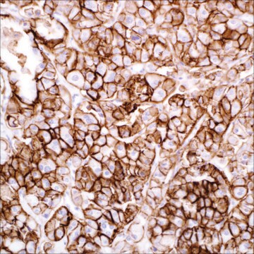 Claudin 7 (5D10F3) Mouse Monoclonal Antibody