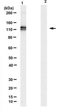 Anti-ADAR1 Antibody, clone RD4B11 clone RD4B11, from rat