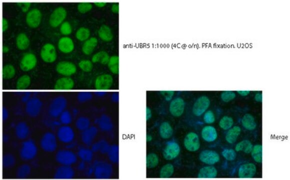 Ligaza białek ubikwityny anty-E3 (UBR5/EDD) serum, from rabbit