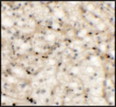 Anti-NKX2-6 antibody produced in rabbit affinity isolated antibody