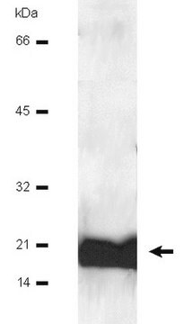 Anticuerpo anti-calmodulina Upstate&#174;, from mouse