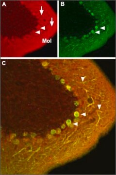 抗 钙通道（&#945; 1C 亚基）（L-型电压门控 Ca2+ 通道） 兔抗 affinity isolated antibody