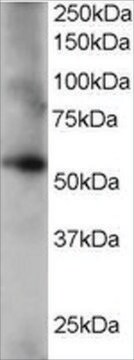 Anti-Coronin 3/Coronin 1C antibody produced in goat affinity isolated antibody, buffered aqueous solution