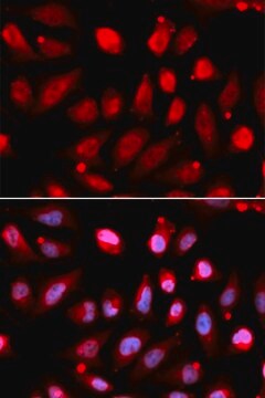 Anti- EZH2/KMT6 antibody produced in rabbit