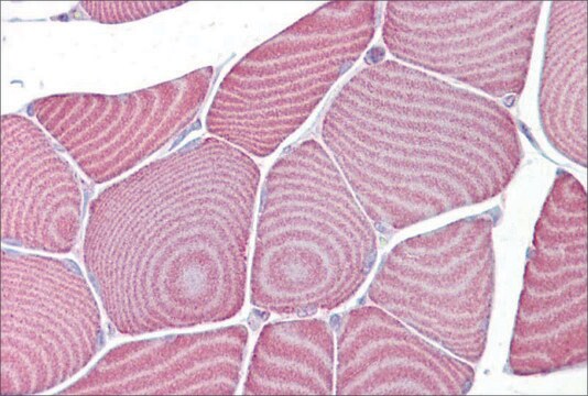 Anti-FABP3 (ab2) antibody produced in rabbit affinity isolated antibody