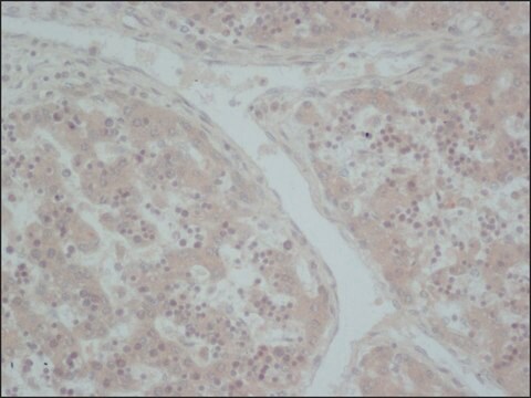 Anti-Nitric Oxide Synthase, Inducible antibody, Mouse monoclonal clone NOS-IN, purified from hybridoma cell culture