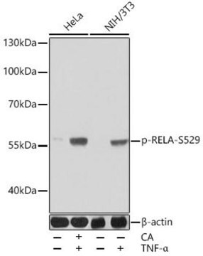 Anti-Phospho-RELA-S529 antibody produced in rabbit