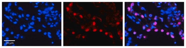 Anti-DNAJB1 antibody produced in rabbit affinity isolated antibody