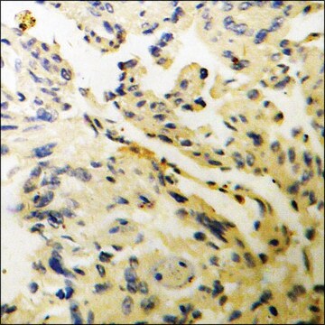 Anti-phospho-WNK1 (pThr58) antibody produced in rabbit affinity isolated antibody