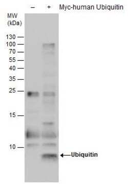 モノクローナル抗ユビキチン抗体 マウス宿主抗体 clone GT7811, affinity isolated antibody