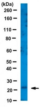 Anti-Thymidylate Kinase/TMPK Antibody from rabbit