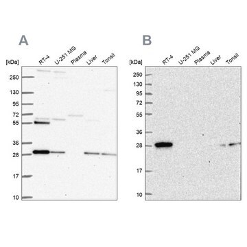 Anti-PMM2 antibody produced in rabbit Prestige Antibodies&#174; Powered by Atlas Antibodies, affinity isolated antibody