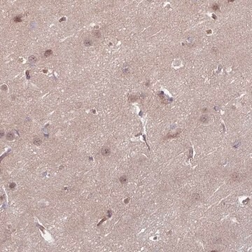 Anti-DAAM2 antibody produced in rabbit Prestige Antibodies&#174; Powered by Atlas Antibodies, affinity isolated antibody, buffered aqueous glycerol solution