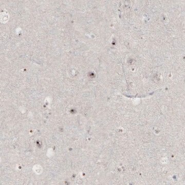 Anti-DKC1 antibody produced in rabbit Ab1, Prestige Antibodies&#174; Powered by Atlas Antibodies, affinity isolated antibody, buffered aqueous glycerol solution