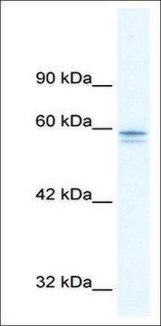 抗-MTF1 兔抗 IgG fraction of antiserum