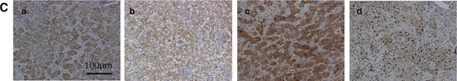 抗 ARG1 (AB2) 兔抗 IgG fraction of antiserum