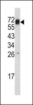 ANTI-CD105 (CENTER E395) antibody produced in rabbit purified immunoglobulin, buffered aqueous solution