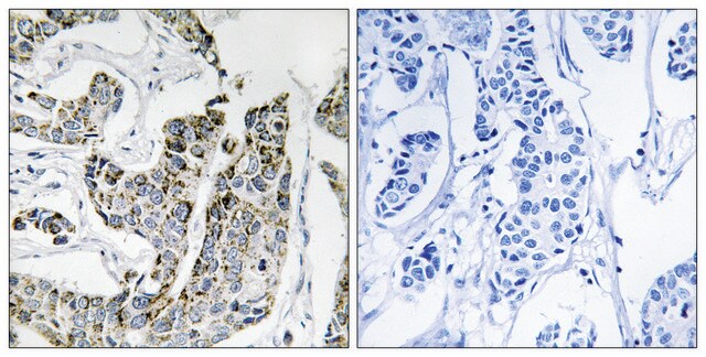 Anti-phospho-BLK (pTyr501) antibody produced in rabbit affinity isolated antibody