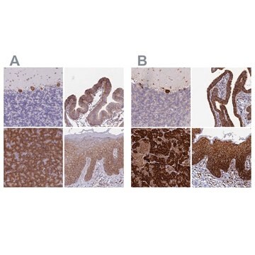 Anti-RPL8 antibody produced in rabbit Prestige Antibodies&#174; Powered by Atlas Antibodies, affinity isolated antibody, buffered aqueous glycerol solution