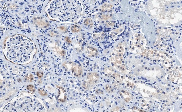 Anti-CDK6 Antibody, clone 2J3 ZooMAb&#174; Rabbit Monoclonal recombinant, expressed in HEK 293 cells