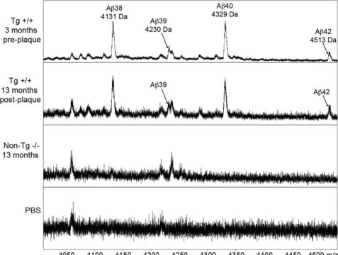 Anti-Amyloid-&#946;-Antikörper, Klon&nbsp;W0-2 clone WO2, from mouse