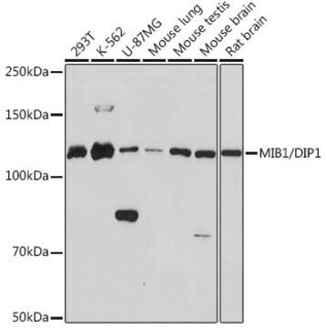 Anti-MIB1/DIP1 Antibody, clone 9Q4N9, Rabbit Monoclonal