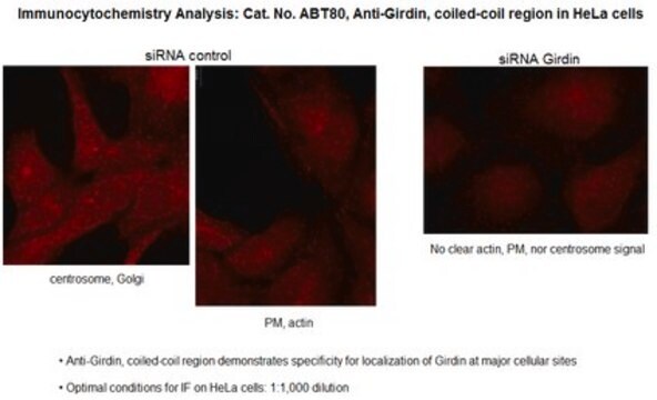 Anti-Girdin, coiled-coil region Antibody from rabbit, purified by affinity chromatography