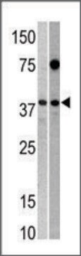 Anti-RCL1 (N-term) antibody produced in rabbit IgG fraction of antiserum, buffered aqueous solution