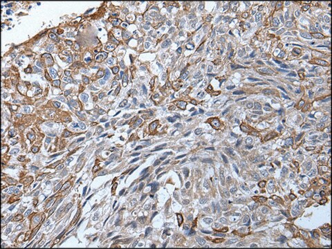 Anti-TRPC5 affinity isolated antibody