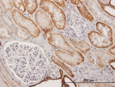 Anti-CDH16 antibody produced in mouse purified immunoglobulin, buffered aqueous solution