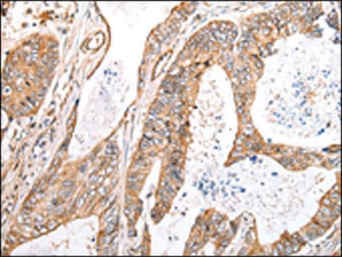 Anty-KCTD16 affinity isolated antibody